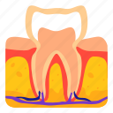tooth, dental, dentist, root, canal, human