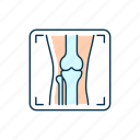arthritis x ray, osteoarthritis, radiology