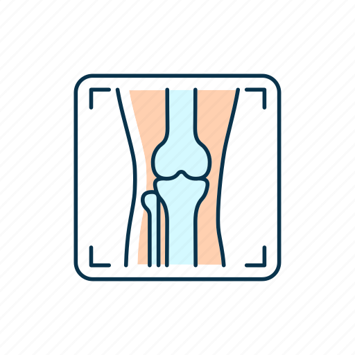 Arthritis x ray, osteoarthritis, radiology icon - Download on Iconfinder