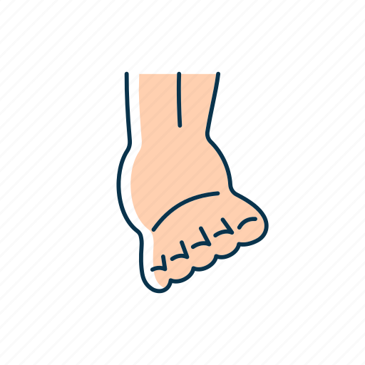 Joint sprain, ligaments tearing, swelling, inflammation icon - Download on Iconfinder