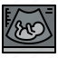 ultrasound, baby, medical, pregnancy 