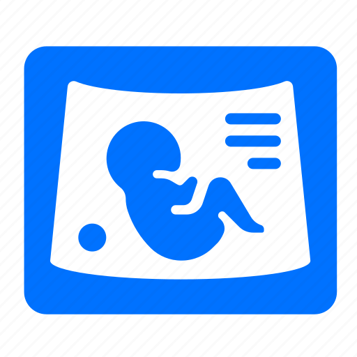Maternity, monitor, pregnancy, sonigram icon - Download on Iconfinder