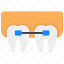 braces, dental, dental braces, dental care, dental health, dentistry, orthodontic 