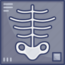 health, healthcare, medical, ray, scan, skeleton, x