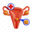 cervical, cancer, health, disease, medicine, woman, infection, month, uterus, awareness 
