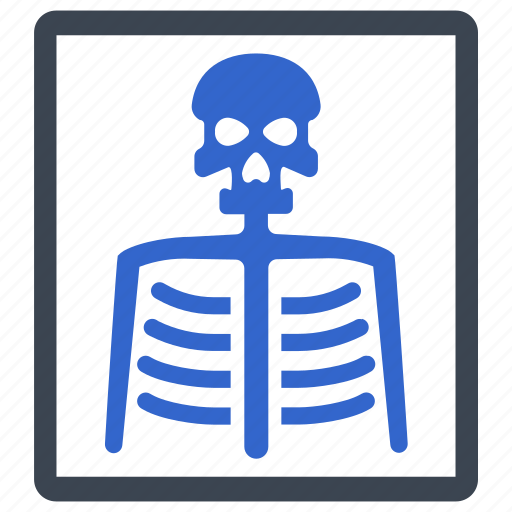 Bones, medical, radiology, ray, skeleton, x ray icon - Download on Iconfinder