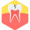 cavity, tooth, care, dental, dentistry, stomatology