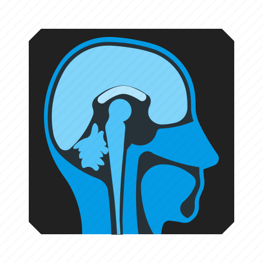 Head, scan, brain, mri, snap icon - Download on Iconfinder