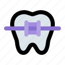 braces, bracket, dental, dentist, in, orthodontic, tooth