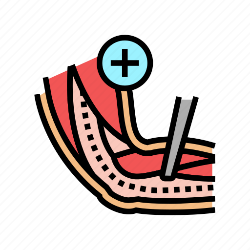Ulnar, nerve, release, neurosurgery, medical, treatment icon - Download on Iconfinder