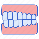 crossbite, dental, tooth, dentist