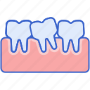 misaligned, teeth, dental, tooth