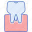molars, tooth, dentist, dental 