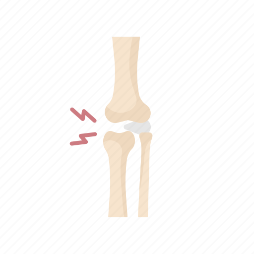 Knee, arthrosis, disc, herniation, bone, joint, skeleton icon - Download on Iconfinder