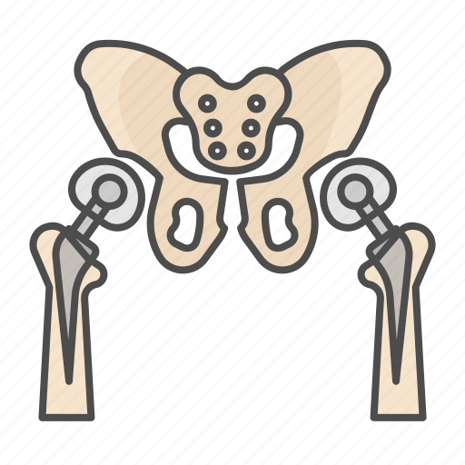 Arthroplasty, hips, bone, skeleton, implant, replacement, orthopedic icon - Download on Iconfinder