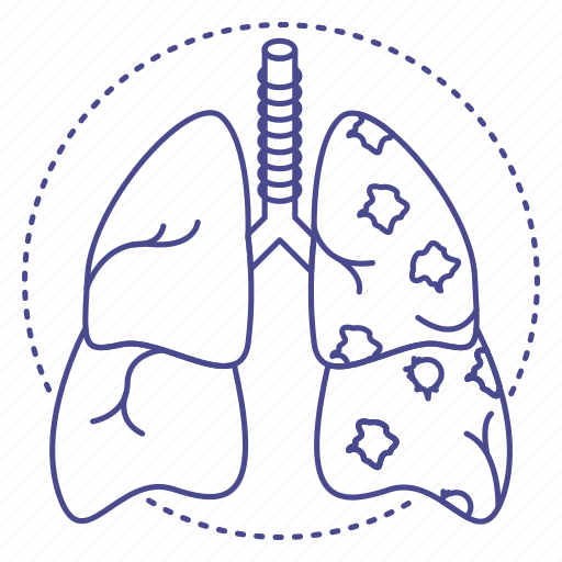 Lungs, organ, unhealthy, lung, smoke, cancer, covide-19 icon - Download on Iconfinder