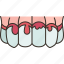 teeth, bleeding, gums, oral, disease 
