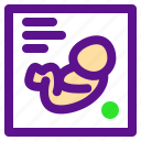 baby, birth, diagram, parents, pregnant