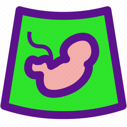 Baby, ecography, pregnant icon - Download on Iconfinder