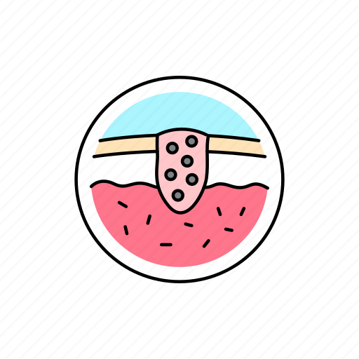 Layer, skin, disease, cancer icon - Download on Iconfinder