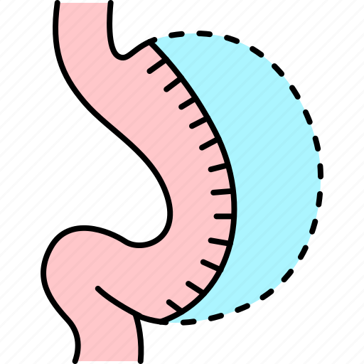 Sleeve, gastrectomy, surgical, weight, loss, reduced, size icon - Download on Iconfinder