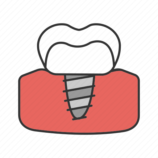 Dental, endosseous, implant, orthodontology, prosthesis, tooth, treatment icon - Download on Iconfinder