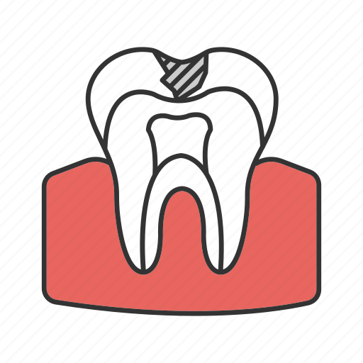 Anatomy, caries, dental, dentin, sick, tooth, treatment icon - Download on Iconfinder
