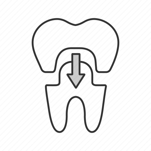 Crown, dental, dentistry, fake, prosthesis, restoration, tooth icon - Download on Iconfinder