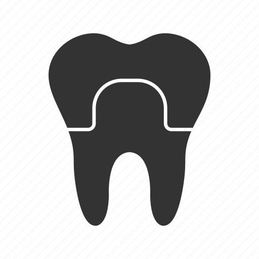 Crown, dental, implant, restoration, teeth, tooth, treatment icon - Download on Iconfinder