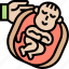 caesarean, childbirth, operation, newborn, maternity 