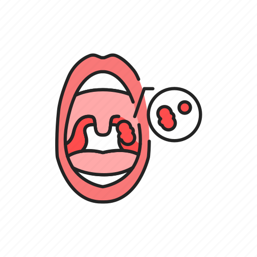 Open, mouth, adenoids icon - Download on Iconfinder