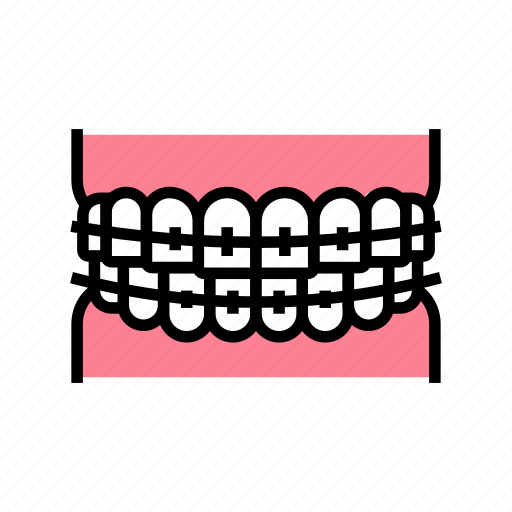 Tooth, braces, accessory, installation, correction, metal icon - Download on Iconfinder