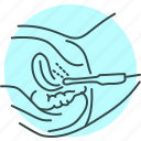 ultrasound, gynecology, female