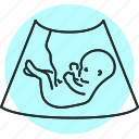 ultrasound, embryo, uterus, pregnancy