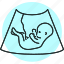 ultrasound, embryo, uterus, pregnancy 