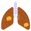 lungs disease, lungs cancer, adenocarcinoma, lung carcinoma, bronchitis 